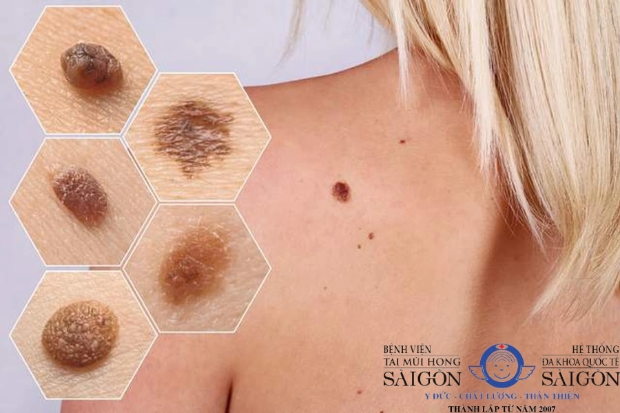 ung thư chữa được không